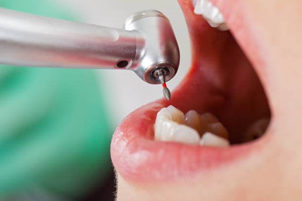 Best Emergency Dental Care for Sports Injuries in Cienegas Terrace, TX